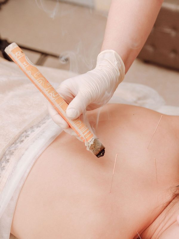 MOXIBUSTION-Port-Macquarie-nsw